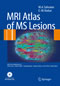 MRI Atlas of MS Lesions