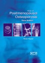 Atlas of Postmenopausal Osteoporosis - Third Edition