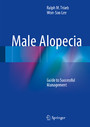 Male Alopecia - Guide to Successful Management