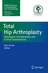 Total Hip Arthroplasty - Tribological Considerations and Clinical Consequences